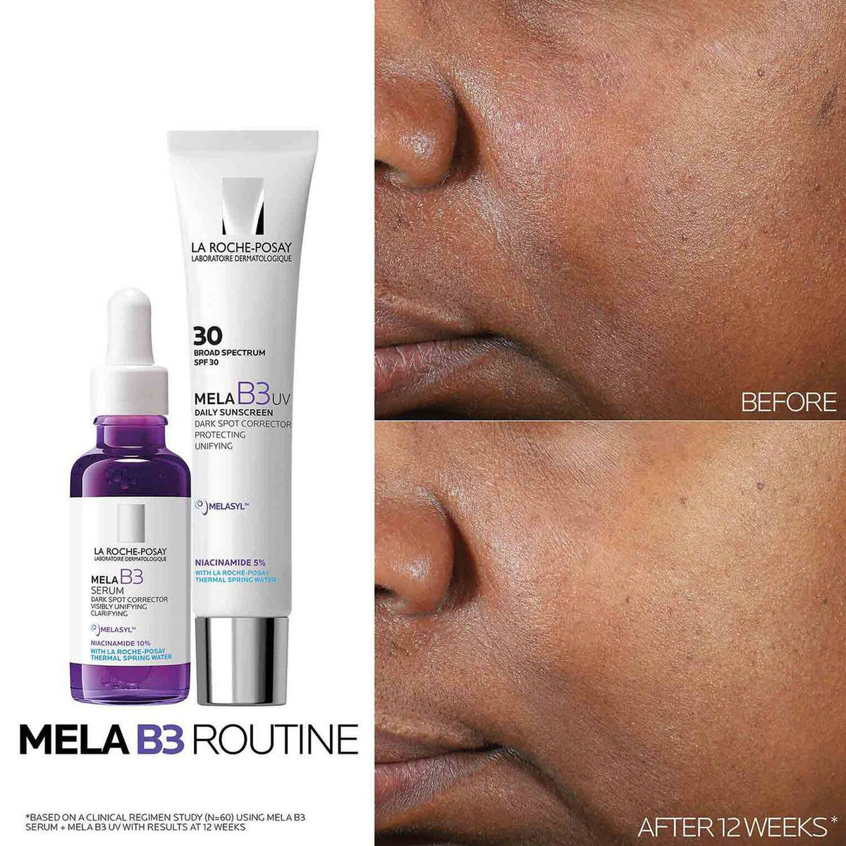 mela-b3-dark-spot-serum-and-mela-b3-uv-daily-moisturizer-with-spf-30-a8 3-Mela-B3-routine_1500X1500.jpg 3-Mela-B3-routine_1500X1500_699afb5eaaaf.jpg
