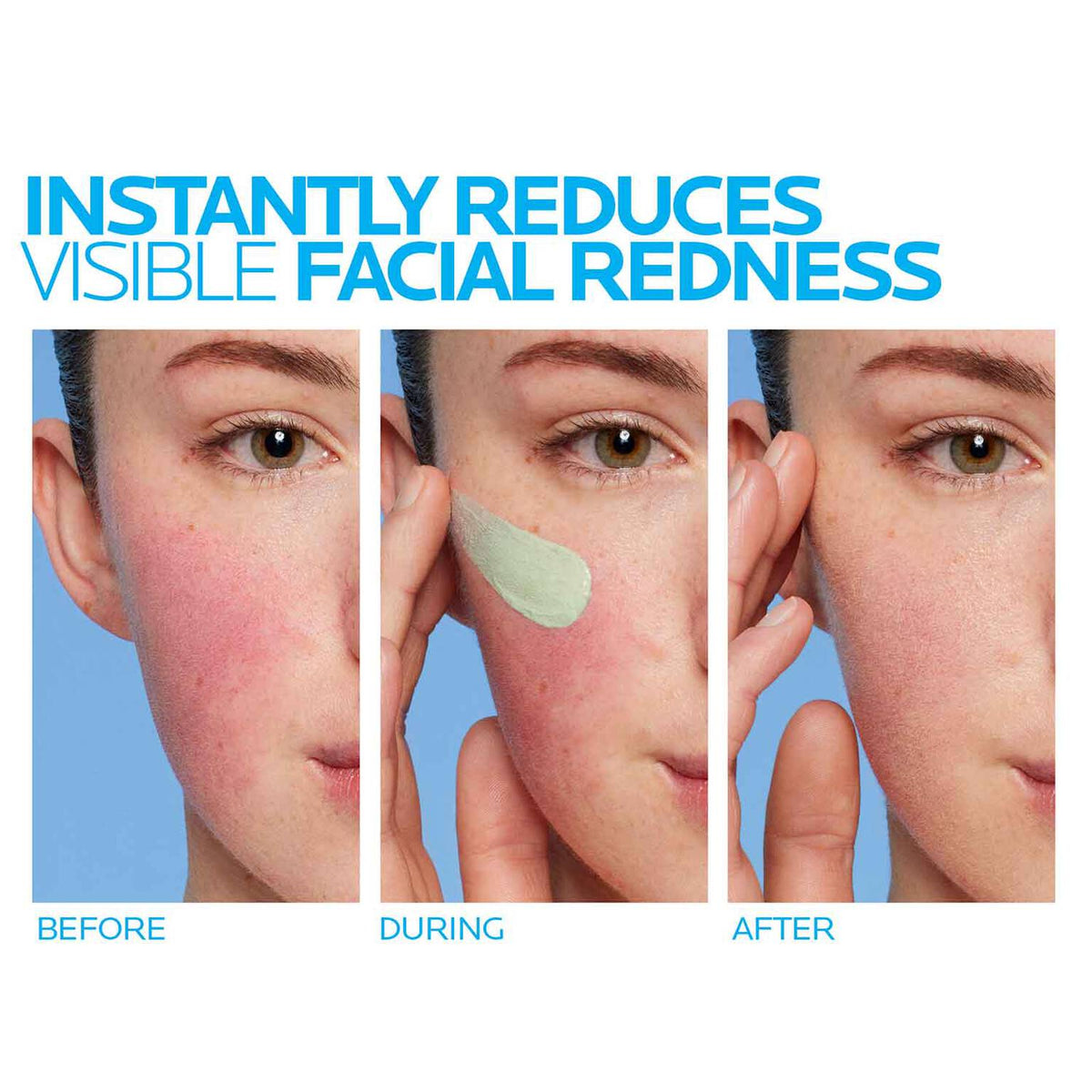 toleriane-rosaliac-ar-face-cream-for-visible-redness-b5 8_Toleriane_Rosaliac-AR-before-after.jpg 8_Toleriane_Rosaliac-AR-before-after_52d4967404aa.jpg