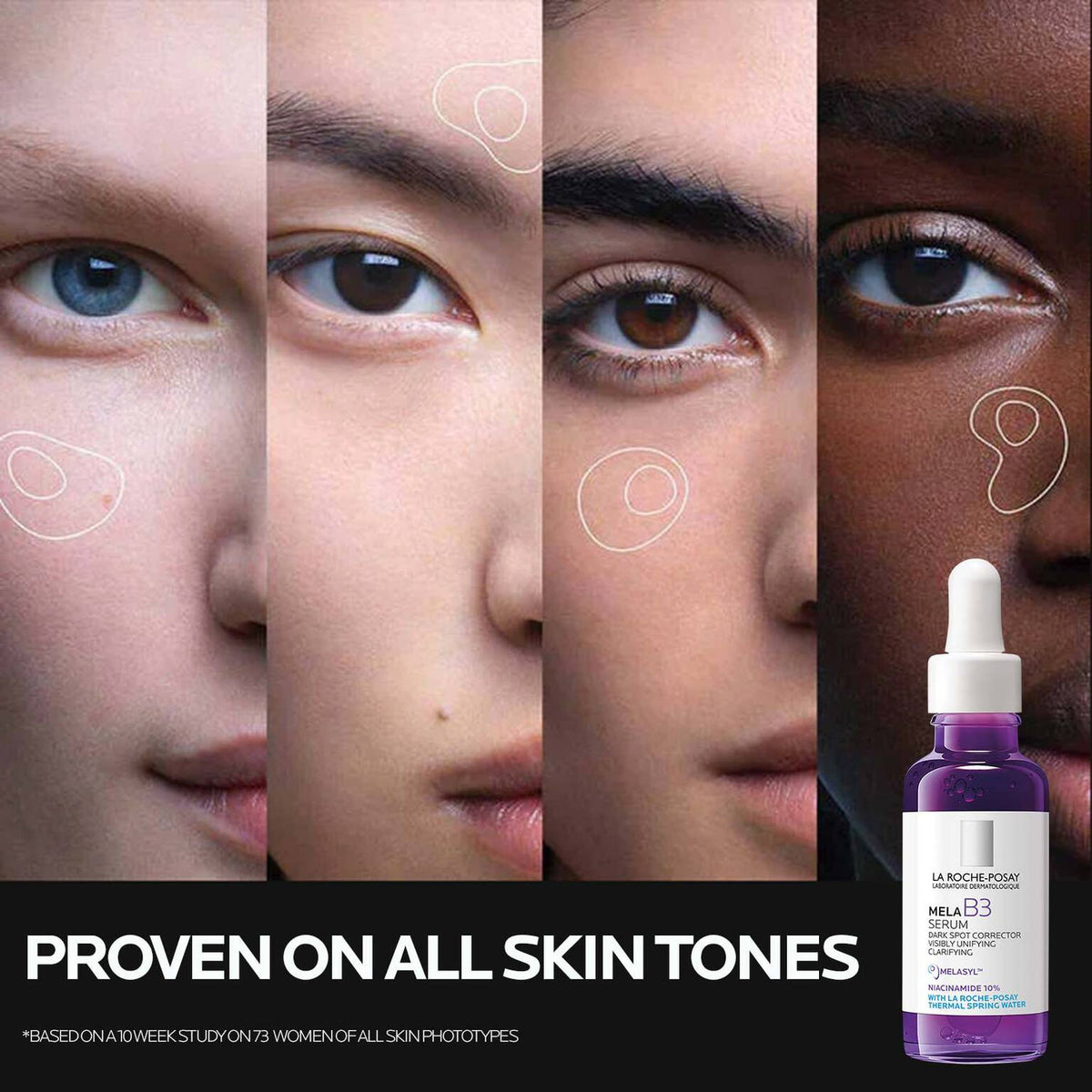 mela-b3-dark-spot-serum-with-melasyltm-niacinamide-z3 Mela-B3-SuitableFor-1500x1500.jpg Mela-B3-SuitableFor-1500x1500_a2d4a8a37f86.jpg