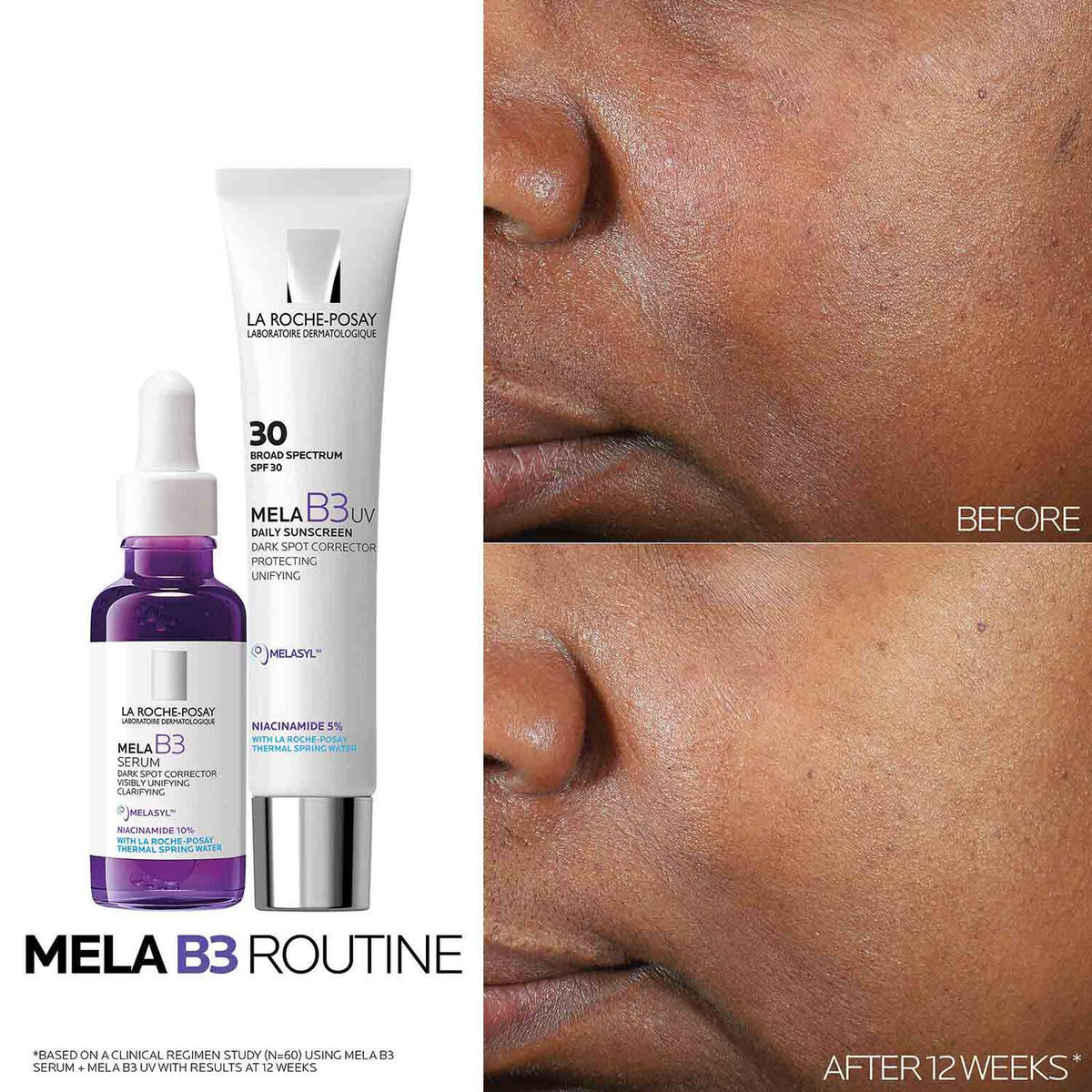 mela-b3-uv-daily-moisturizer-spf-30-with-melasyltm-niacinamide-o4 Mela-B3-routine_1500X1500.jpg Mela-B3-routine_1500X1500_4218e8d2a51a.jpg