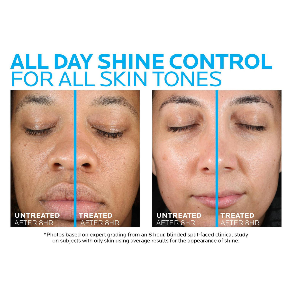 toleriane-double-repair-matte-face-moisturizer-for-oily-skin-b1 la-roche-posay-toleriane-matte-moisturizer-before-and-after-pdp-alt.jpg la-roche-posay-toleriane-matte-moisturizer-before-and-after-pdp-alt_29894fb3234d.jpg